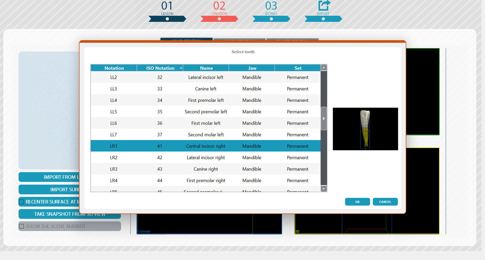 Virteasy Editor screen for selecting a tooth model
